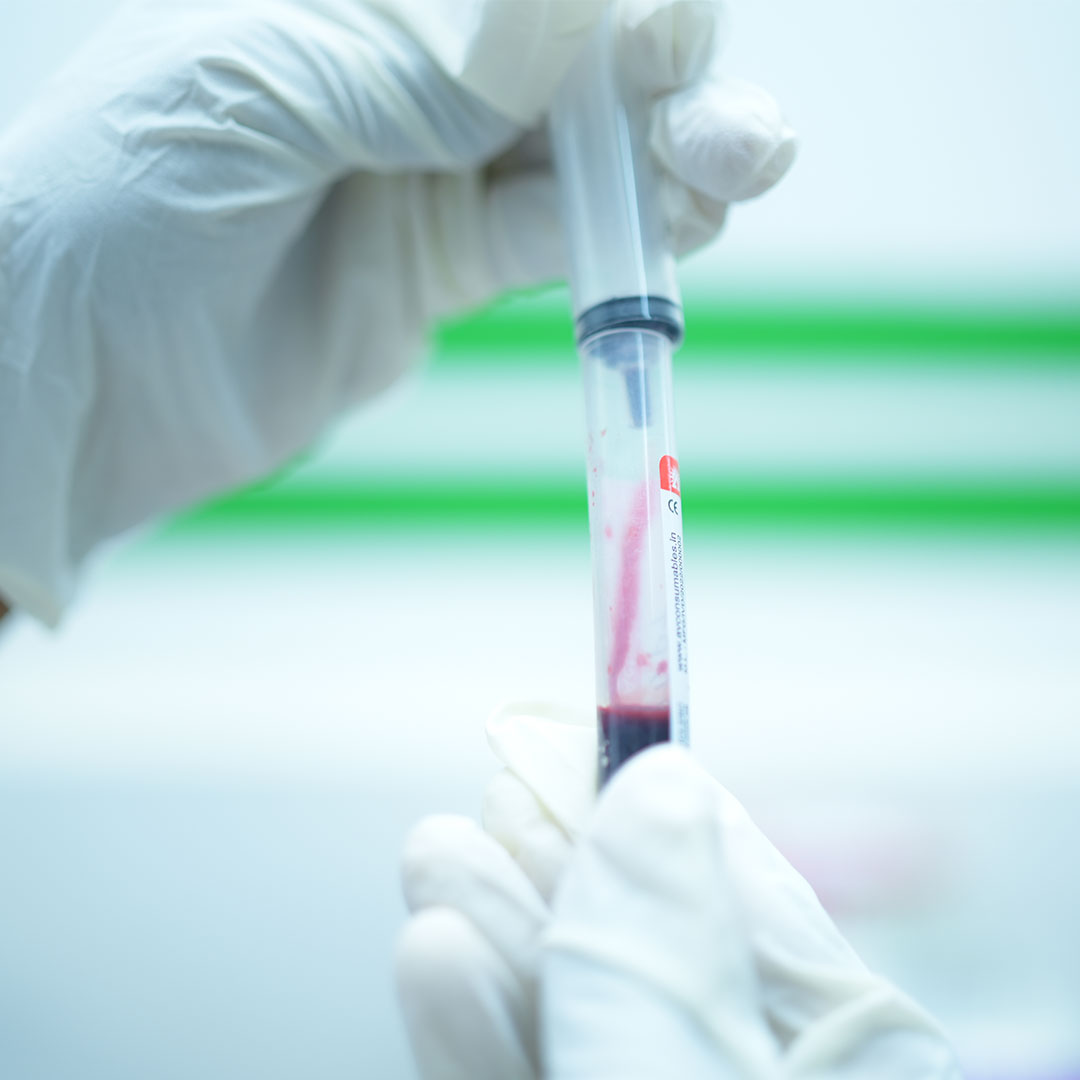 aswas dignostics your testing pattner